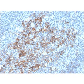 Biotium BNUM3592-50, CD23 (Fc Epsilon RII)(FCER2/3592), 1mg/mL