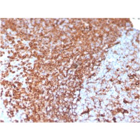 Vimentin (Mesenchymal Cell Marker)(VIM/3736), 1mg/mL