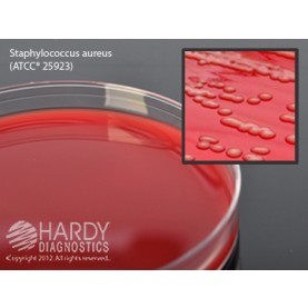 Hardy Diagnostic A10BX Dry Culture Media, Blood Agar 5% Plate,  90 Day Shelf Life (Pack of 100)