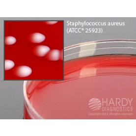 Hardy Diagnostic A16 Dry Culture Media, Columbia Blood Agar Plate,  90 Day Shelf Life (Pack of 10)