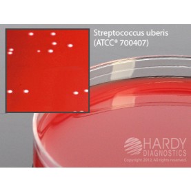 Hardy Diagnostic A188 Dry Culture Media, Bovine Blood Agar Plate,  100 Day Shelf Life (Pack of 10)