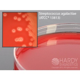 Hardy Diagnostic A300 Dry Culture Media, GBS Detect Plate,  70 Day Shelf Life (Pack of 10)