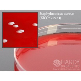 Hardy Diagnostic A50 Dry Culture Media, Columbia CNA Agar Plate,  80 Day Shelf Life (Pack of 10)