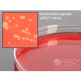 Hardy Diagnostic A80 Dry Culture Media, V Agar/ G. vaginalis Plate,  42 Day Shelf Life (Pack of 10)