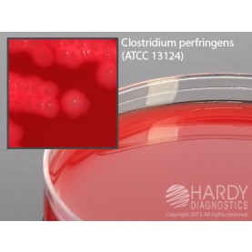 Hardy Diagnostic A98 Dry Culture Media, Schaedler Agar w/ SB Plate,  90 Day Shelf Life (Pack of 10)