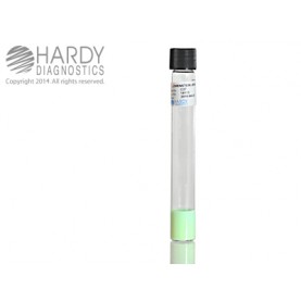 Hardy Diagnostic C27 Liquid Culture Media, LJ Deep Tube,  730 Day Shelf Life (Pack of 20)