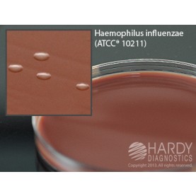 Hardy Diagnostic E11 Dry Culture Media, Chocolate Agar w/ Bacitrac Plate,  90 Day Shelf Life (Pack of 10)