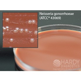 Hardy Diagnostic E130BX Dry Culture Media, Thayer Martin w/ VCN Plate,  70 Day Shelf Life (Pack of 100)