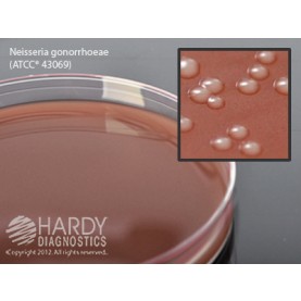 Hardy Diagnostic E14BX Dry Culture Media, Chocolate Agar Plate,  90 Day Shelf Life (Pack of 100)