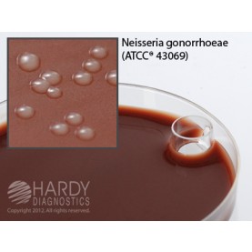 Hardy Diagnostic E31 Dry Culture Media, Martin Lewis w/ Lincomycin Plate,  90 Day Shelf Life (Pack of 10)