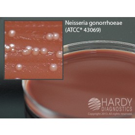 Hardy Diagnostic E39 Dry Culture Media, Martin Lewis w/ Lincomycin Plate,  90 Day Shelf Life (Pack of 10)