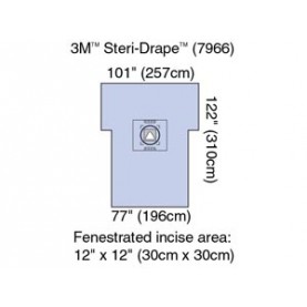 3M Health Care 7966 Cesarean-Section Sheet with Aperture Pouch, 77" x 122", 5/cs (Continental US+HI Only)