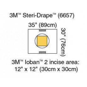 3M Health Care 6657 Cesarean-Section Pouch with Ioban 2 Incise Film, 35" x 30", 10/bx, 4 bx/cs (Continental US+HI Only)