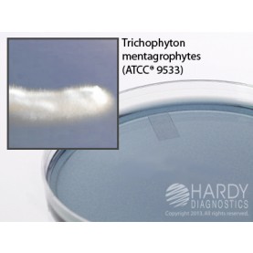 Hardy Diagnostic G01 Dry Culture Media, YM-11 Agar Plate,  100 Day Shelf Life (Pack of 10)