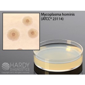 Hardy Diagnostic G02 Dry Culture Media, A8 for Mycoplasma Plate,  84 Day Shelf Life (Pack of 10)