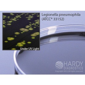 Hardy Diagnostic G08 Dry Culture Media, BCYE Selective Agar w/ CAV Plate,  70 Day Shelf Life (Pack of 10)