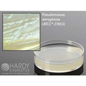 Hardy Diagnostic G138 Dry Culture Media, Skim Milk Agar Plate,  90 Day Shelf Life (Pack of 10)