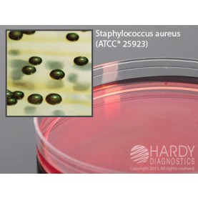 Hardy Diagnostic G193 Dry Culture Media, Vogel and Johnson Agar Plate,  90 Day Shelf Life (Pack of 10)