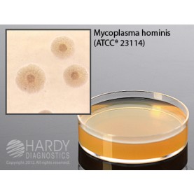 Hardy Diagnostic G21 Dry Culture Media, SP4 Agar w/ Glucose Plate,  84 Day Shelf Life (Pack of 10)