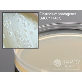 Hardy Diagnostic G215 Liquid Culture Media, Egg Yolk Agar Plate,  90 Day Shelf Life (Pack of 10)