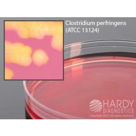 Hardy Diagnostic G251 Dry Culture Media, Sulfite Polymyxin Milk Ag Plate,  60 Day Shelf Life (Pack of 10)