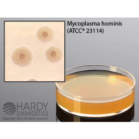 Hardy Diagnostic G32 Dry Culture Media, SP4 Agar w/ Arginine Plate,  84 Day Shelf Life (Pack of 10)