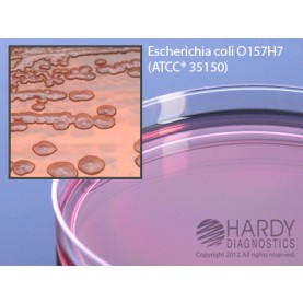 Hardy Diagnostic G36 Dry Culture Media, MacConkey Agar w/ Sorbitol Plate,  90 Day Shelf Life (Pack of 10)