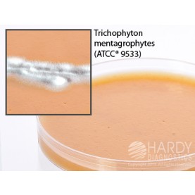 Hardy Diagnostic G98 Dry Culture Media, V9 Agar Plate,  90 Day Shelf Life (Pack of 10)