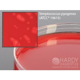 Hardy Diagnostic H28 Dry Culture Media,  Blood Agar 5% Plate,  90 Day Shelf Life (Pack of 10)