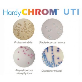 Hardy Diagnostic J119 Dry Culture Media, Blood Agar/UTI Biplate,  90 Day Shelf Life (Pack of 10)