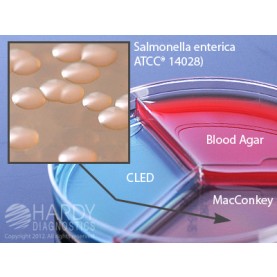 Hardy Diagnostic J315 Dry Culture Media, TSA Blood/CLED/MAC Triplate,  90 Day Shelf Life (Pack of 10)