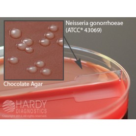 Hardy Diagnostic J42 Dry Culture Media, Blood Agar 5%/Chocolate Biplate,  90 Day Shelf Life (Pack of 10)