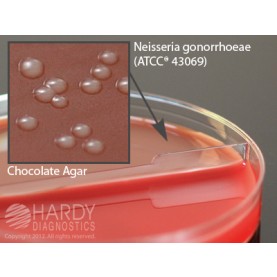 Hardy Diagnostic J42 Dry Culture Media, Blood Agar 5%/Chocolate Biplate,  90 Day Shelf Life (Pack of 10)