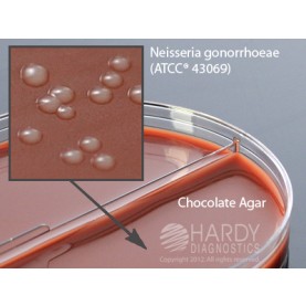 Hardy Diagnostic J72 Dry Culture Media, Chocolate/Mod.Thayr Martn Biplate,  70 Day Shelf Life (Pack of 10)