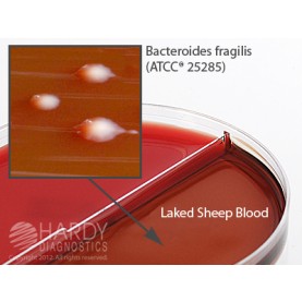 Hardy Diagnostic J87 Dry Culture Media, Brucella/LKV Biplate Biplate,  90 Day Shelf Life (Pack of 10)