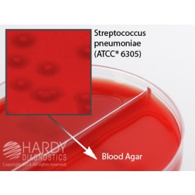 Hardy Diagnostic J92 Dry Culture Media, Grp A Beta Strep/Blood 5% Biplate,  90 Day Shelf Life (Pack of 10)