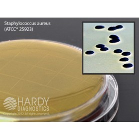 Hardy Diagnostic P16 Dry Culture Media, Baird Parker Agar Contact Plate,  90 Day Shelf Life (Pack of 10)