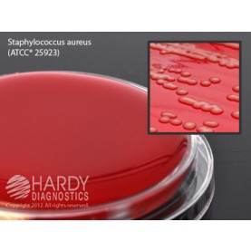 Hardy Diagnostic P33 Dry Culture Media, Blood Agar 5% Contact Plate,  90 Day Shelf Life (Pack of 10)