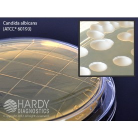 Hardy Diagnostic P36 Dry Culture Media, Sabdex Agar Contact Plate,  102 Day Shelf Life (Pack of 10)