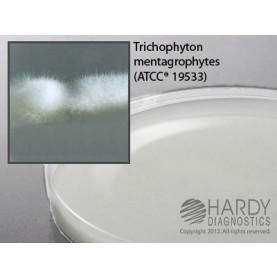 Hardy Diagnostic W159 Dry Culture Media, Potato Flake Selective Agar Plate,  90 Day Shelf Life (Pack of 10)