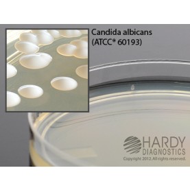 Hardy Diagnostic W20 Dry Culture Media, Sabdex Agar Plate,  90 Day Shelf Life (Pack of 10)