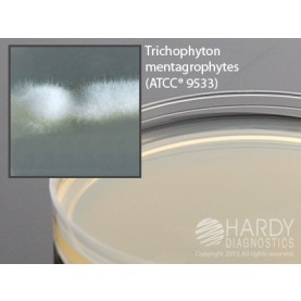 Hardy Diagnostic W25 Dry Culture Media, Inhib.Mold Agar Plate,  90 Day Shelf Life (Pack of 10)