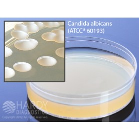 Hardy Diagnostic W250 Liquid Culture Media, SabDex Agar Plate,  60 mL, 90 Day Shelf Life (Pack of 5)