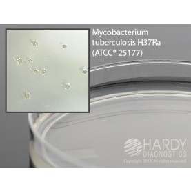 Hardy Diagnostic W30 Dry Culture Media, Middlebrook 7H10 Plate,  120 Day Shelf Life (Pack of 10)