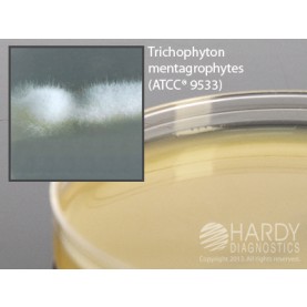 Hardy Diagnostic W58 Liquid Culture Media, Inhibitory Mold Agar Plate,  60 mL, 110 Day Shelf Life (Pack of 5)