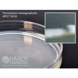 Hardy Diagnostic W60 Dry Culture Media, Potato Dextrose Agar Plate,  90 Day Shelf Life (Pack of 10)