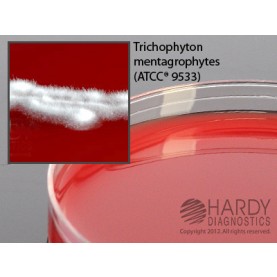 Hardy Diagnostic W65 Dry Culture Media, BHI Agar w/ Blood Plate,  90 Day Shelf Life (Pack of 10)