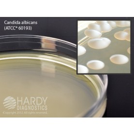 Hardy Diagnostic W70 Dry Culture Media, Sabdex Agar Plate,  90 Day Shelf Life (Pack of 10)