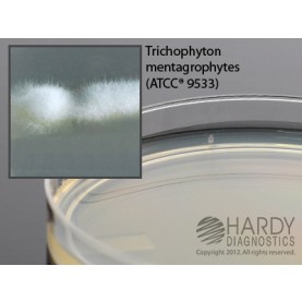 Hardy Diagnostic W73 Dry Culture Media, Sabdex C&G Plate,  90 Day Shelf Life (Pack of 10)