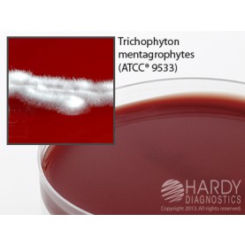 Hardy Diagnostic W95 Dry Culture Media, Liver Infusion Agar Sel. Plate,  90 Day Shelf Life (Pack of 10)